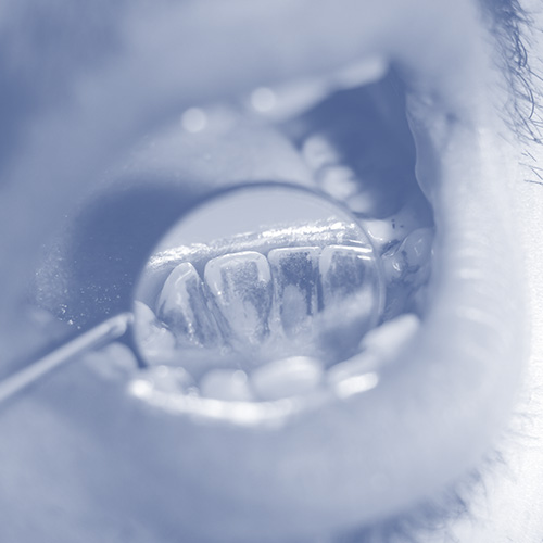 Stains and Discoloration